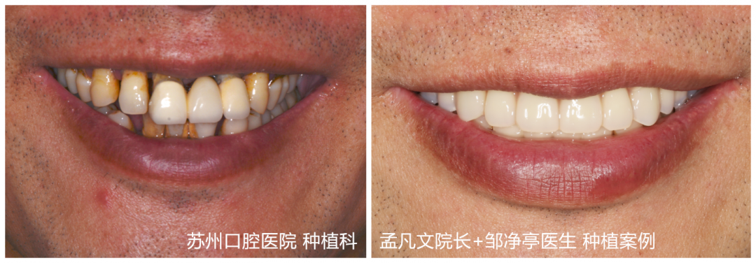 鄒靜亭案例對比.png