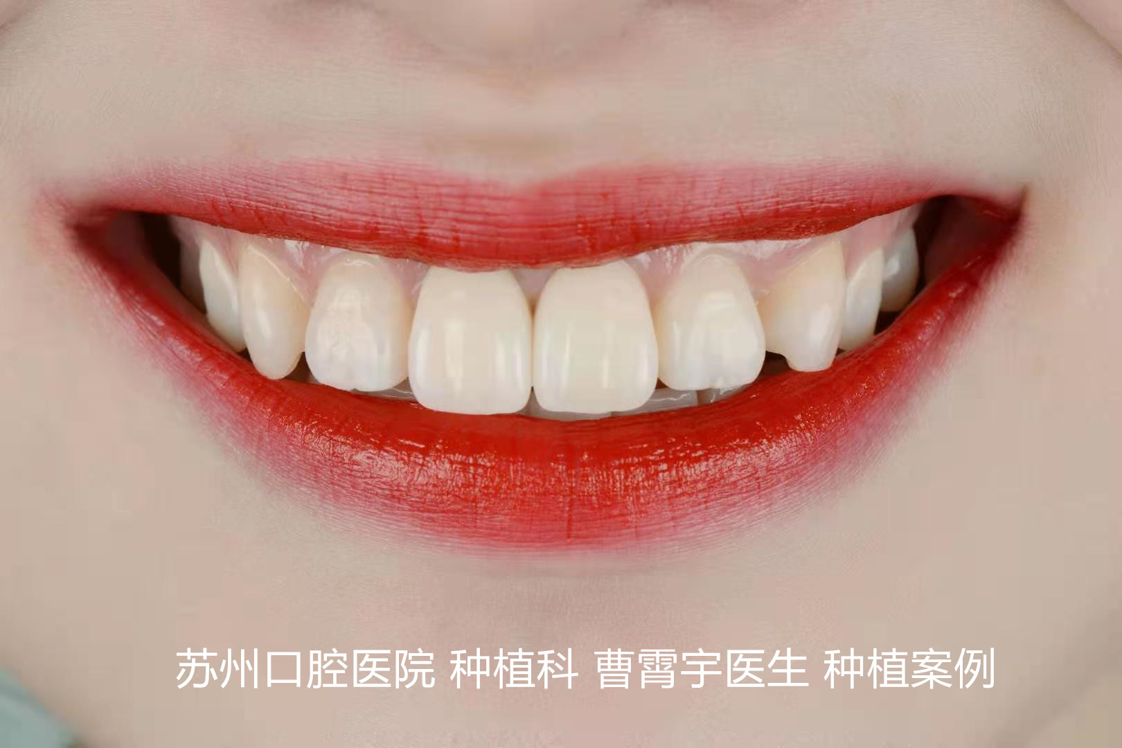 曹霄宇照照.jpg