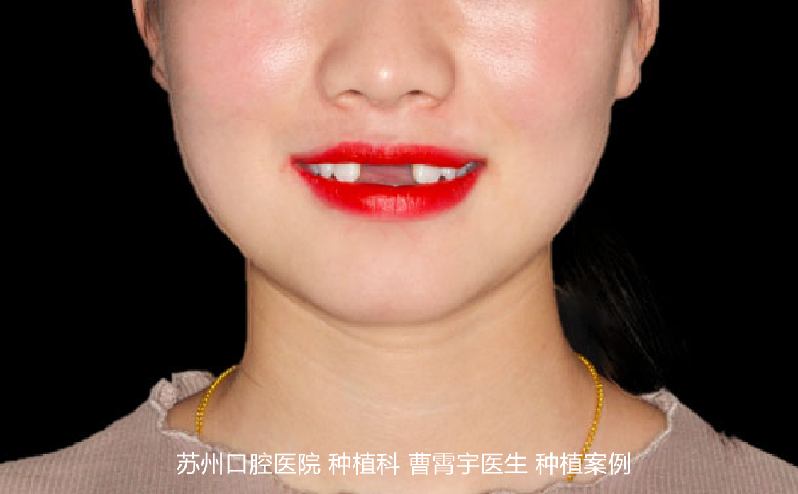 圖片3_副本.png