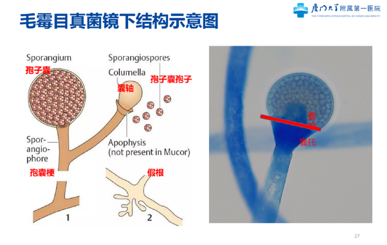 毛霉菌结构图图片
