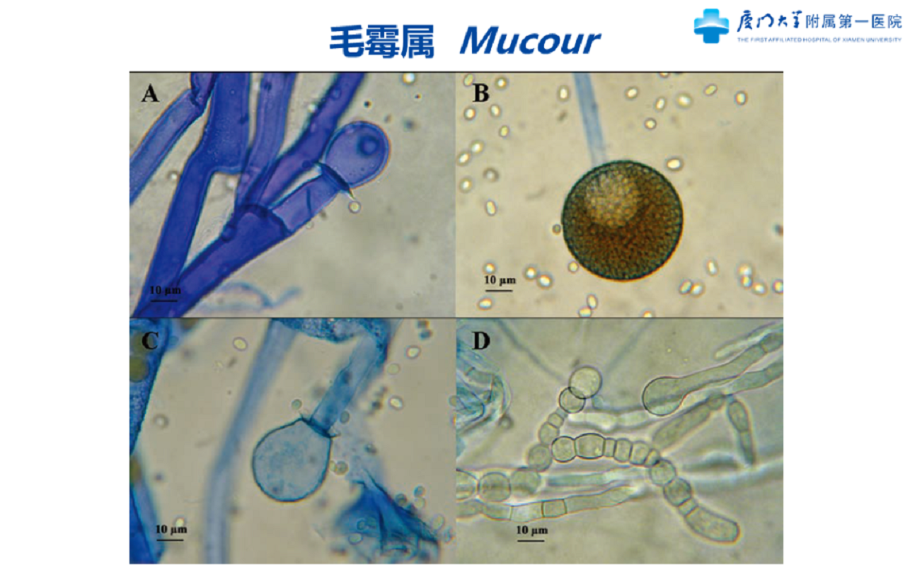 毛霉菌不形成匍匐菌丝,无假根,无囊托,有典型囊领,囊轴球形或近似卵