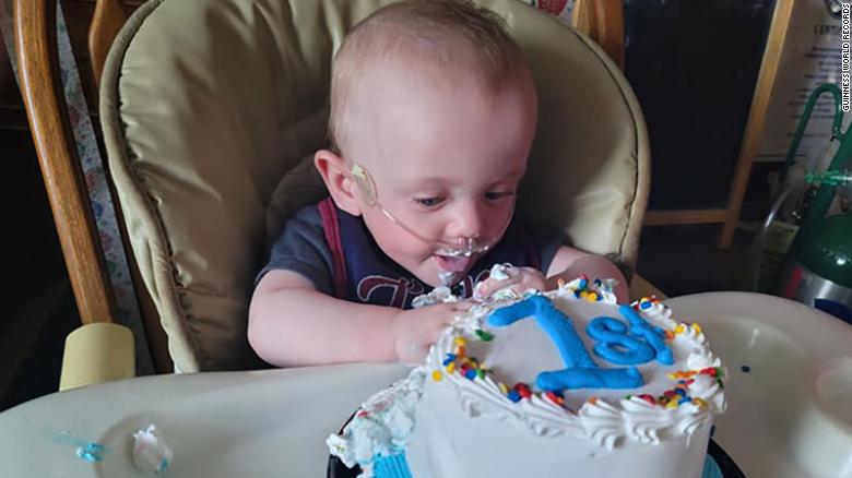 210618001701-01-most-premature-baby-birthday-exlarge-169.jpg