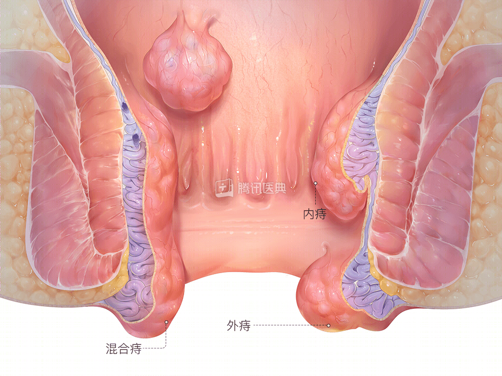 a91b12f0-cebf-11e9-841a-ef49a2c3adb8_2.png