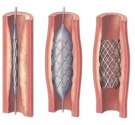image013.png image013.png