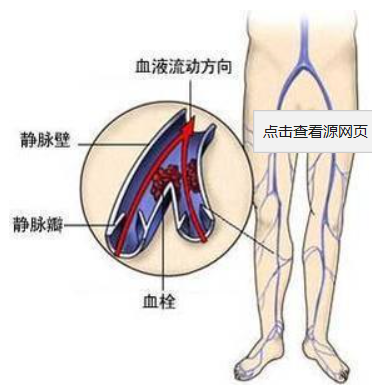图片2.png