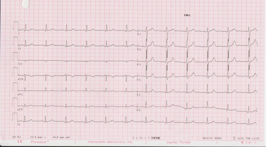 80 mmhg