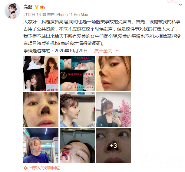 æ¼åé«æº2æ2æ¥èªææ´å½¢å¤±è´¥ç»åï¼å¾æ®å¾®åï¼